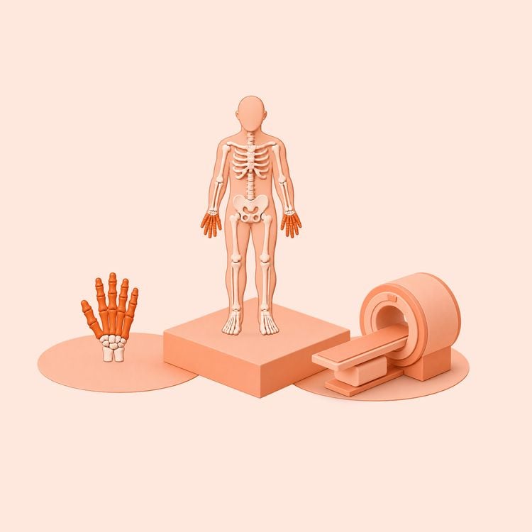 MR Hand